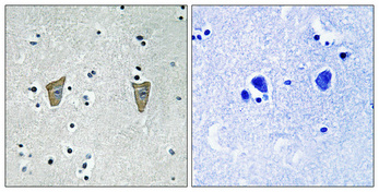 Immunohistochemical analysis of paraffin-embedded Human brain