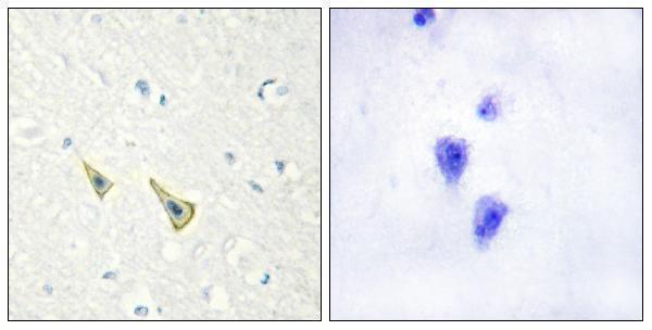 Immunohistochemistry analysis of paraffin-embedded human brain, using Calsenilin/KCNIP3 (Phospho-Ser63) Antibody