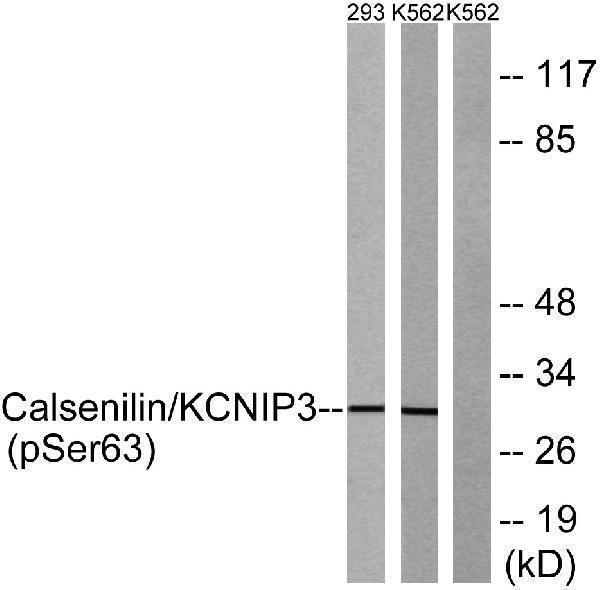 Western blot analysis of lysates from K562 cells treated with forskolin 40nM 30' and 293 cells treated with PMA 125ng/ml 30', using Calsenilin/KCNIP3 (Phospho-Ser63) Antibody