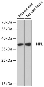 Western blot analysis of extracts of various cell lines, using NPL antibody  at 1:3000 dilution