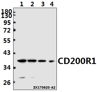 Western blot (WB) analysis of CD200R1 polyclonal antibody at 1:1000 dilution
Lane1:L02 whole cell lysate(40ug)
Lane2:A549 whole cell lysate(40ug)
Lane3:AML-12 whole cell lysate(40ug)
Lane4:H9C2 whole cell lysate(40ug)