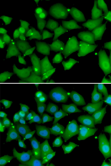 Immunofluorescence analysis of MCF7 cell using RBBP7 antibody