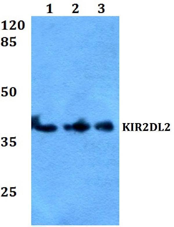 Western blot (WB) analysis of KIR2DL2 polyclonal antibody at 1:500 dilution
Lane1:HEK293T whole cell lysate
Lane2:Mouse liver tissue lysate
Lane3:H9C2 whole cell lysate