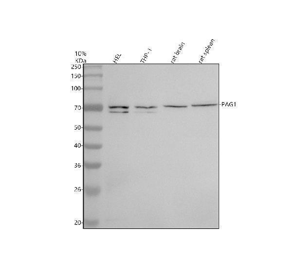 Western blot analysis of PAG1 using anti-PAG1 antibody (A03711-2)
