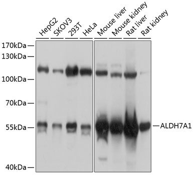 a03712 aldh7a1 primary antiboties wb testing 1