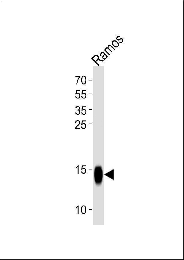 a03713 1 anti tcl1a antibody center wb testing 1