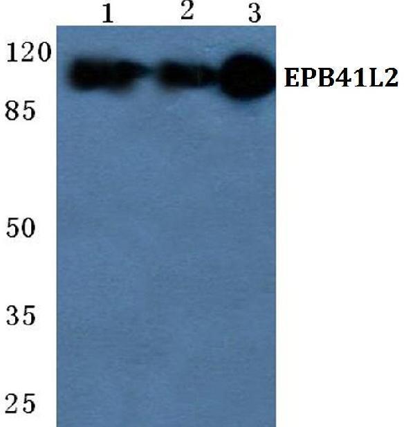Western blot (WB) analysis of EPB41L2 polyclonal antibody at 1:500 dilution
Lane1:Hela cell lysate
Lane2:sp2/0 cell lysate
Lane3:H9C2 cell lysate