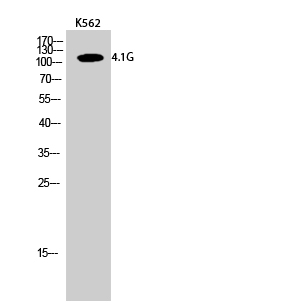 Western Blot analysis of K562 cells using 4