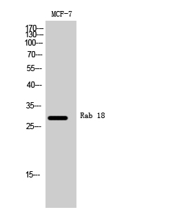 Western Blot (WB) analysis of MCF-7 cells using Rab 18 Polyclonal antibody