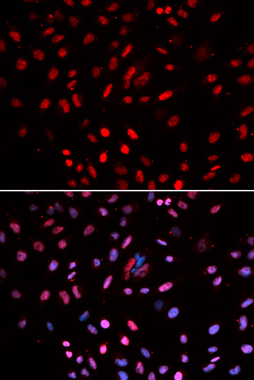 Immunofluorescence analysis of U2OS cells, using DNA pol δ cat polyclonal antibody