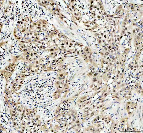 IHC analysis of POLD1 using anti-POLD1 antibody (A03720-2)