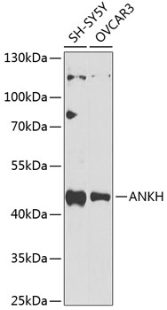 Western blot analysis of extracts of various cell lines, using ANKH Antibody  at 1:1000 dilution