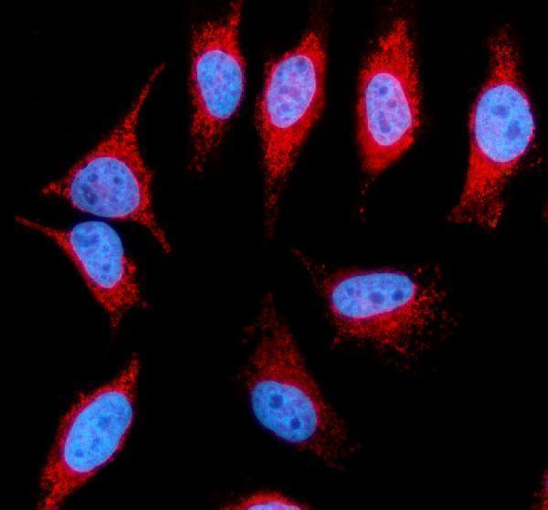 a03722 2 fkbp8 primary antibodies if testing 1