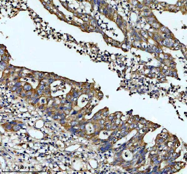 IHC analysis of FKBP8 using anti-FKBP8 antibody (A03722-2)