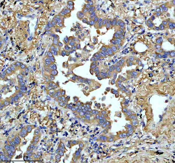 IHC analysis of FKBP8 using anti-FKBP8 antibody (A03722-2)