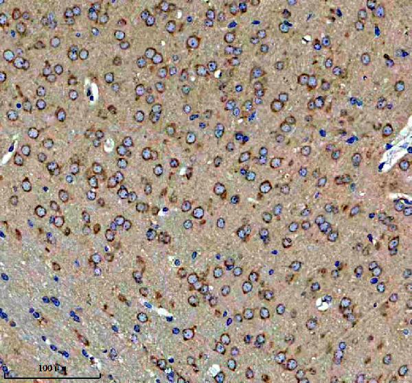a03722 2 fkbp8 primary antibodies ihc testing 3