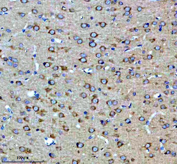 a03722 2 fkbp8 primary antibodies ihc testing 4