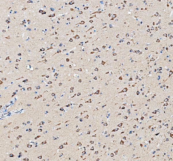 a03722 2 fkbp8 primary antibodies ihc testing 5