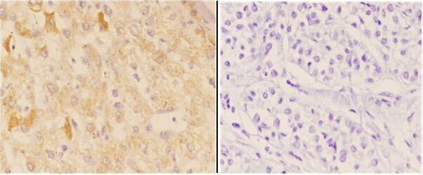 a03723 chrna1 primary antiboties ihc testing 2