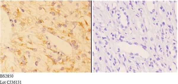 a03723 chrna1 primary antiboties ihc testing 3