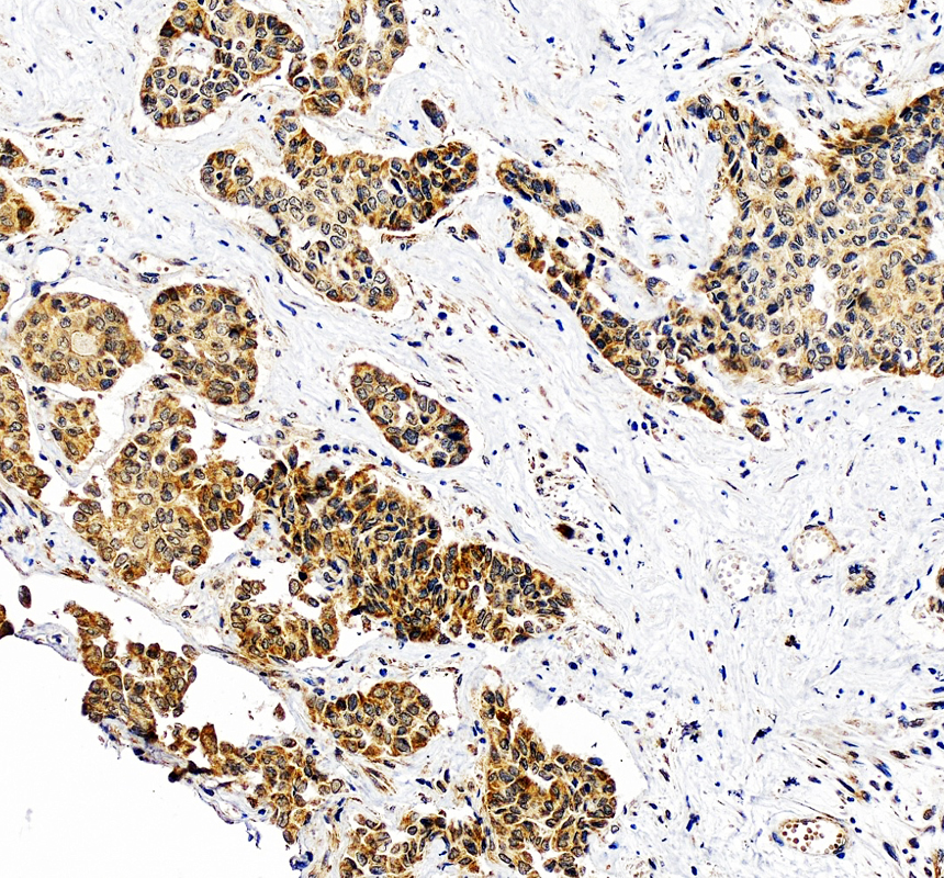 a03724 1 nup107 primary antibodies ihc testing 1