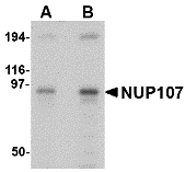 Western blot analysis of NUP107 in A549 cell lysate with NUP107 antibody at (A) 1 and (B) 2 μg/mL