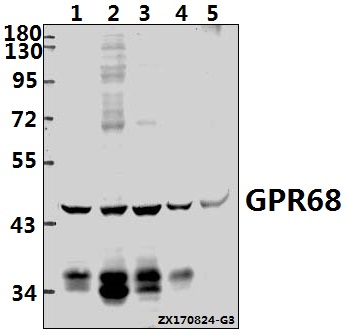 Western blot (WB) analysis of GPR68 (R214) pAb at 1:500 dilution
Lane1:U-87MG whole cell lysate(40ug)
Lane2:K562 whole cell lysate(40ug)
Lane3:MCF-7 whole cell lysate(40ug)
Lane4:The Lung tissue lysate of Mouse(40ug)
Lane5:The Lung tissue lysate of Rat(40ug)