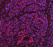 a03727 1 ddx1 primary antibodies if testing 2