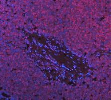 a03727 1 ddx1 primary antibodies if testing 3