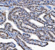 a03727 1 ddx1 primary antibodies ihc testing 10