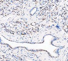 a03727 1 ddx1 primary antibodies ihc testing 11