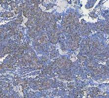 a03727 1 ddx1 primary antibodies ihc testing 12