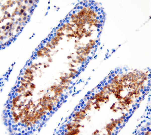  IHC analysis of DDX1 using anti-DDX1 antibody (A03727-1)