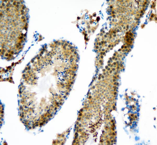 a03727 1 ddx1 primary antibodies ihc testing 3_1