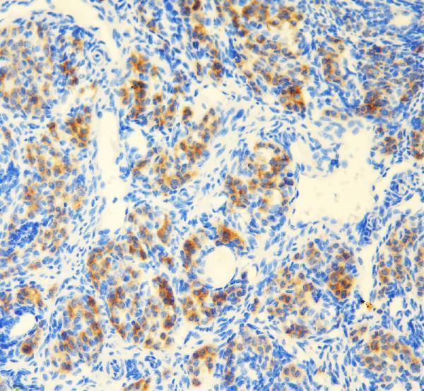 a03727 1 ddx1 primary antibodies ihc testing 4_1
