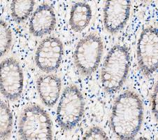 a03727 1 ddx1 primary antibodies ihc testing 5