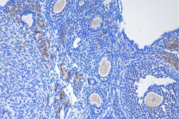 a03727 1 ddx1 primary antibodies ihc testing 5_1