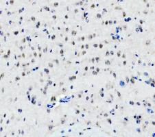 a03727 1 ddx1 primary antibodies ihc testing 6