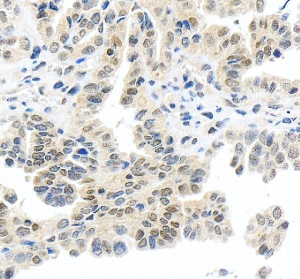 IHC analysis of DDX1 using anti-DDX1 antibody (A03727-1)