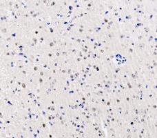 a03727 1 ddx1 primary antibodies ihc testing 7