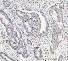 a03727 1 ddx1 primary antibodies ihc testing 8