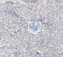 a03727 1 ddx1 primary antibodies ihc testing 9