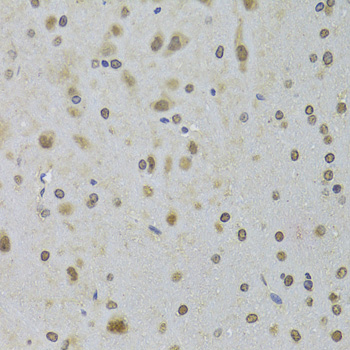 a03727 ddx1 primary antiboties ihc testing 2