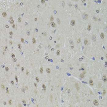 a03727 ddx1 primary antiboties ihc testing 4