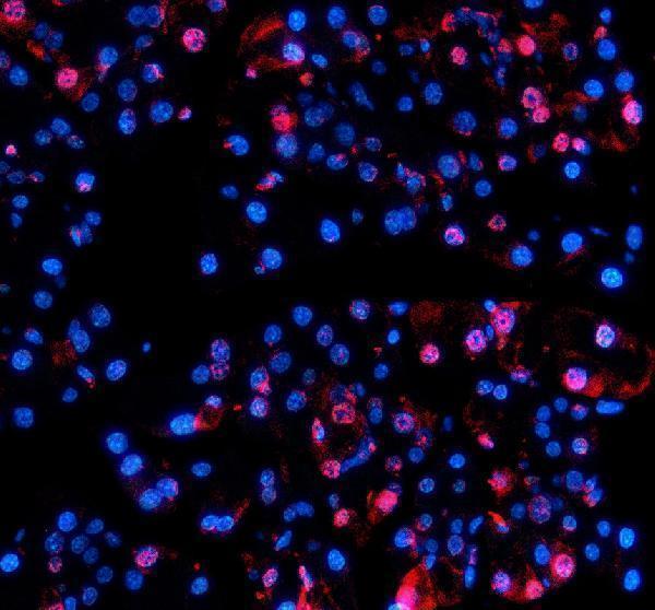 a03729 2 nupr1 primary antibodies if testing 1