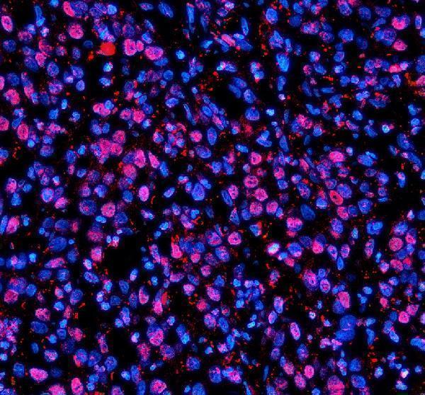 a03729 2 nupr1 primary antibodies if testing 2