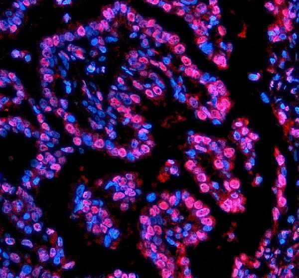a03729 2 nupr1 primary antibodies if testing 3