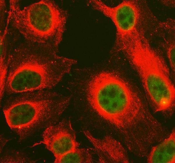 a03729 2 nupr1 primary antibodies if testing 4