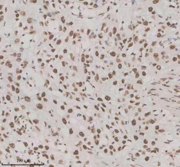 IHC analysis of NUPR1 using anti-NUPR1 antibody (A03729-2)