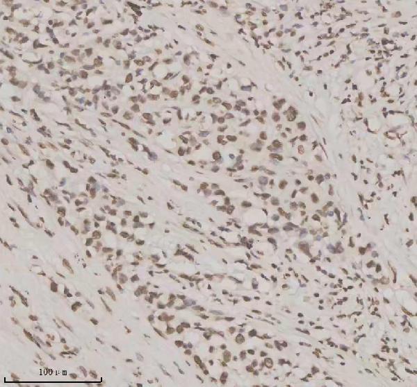 IHC analysis of NUPR1 using anti-NUPR1 antibody (A03729-2)